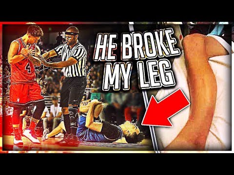 He Broke My Leg At Ace Family Event (Charity Basketball Highlights)