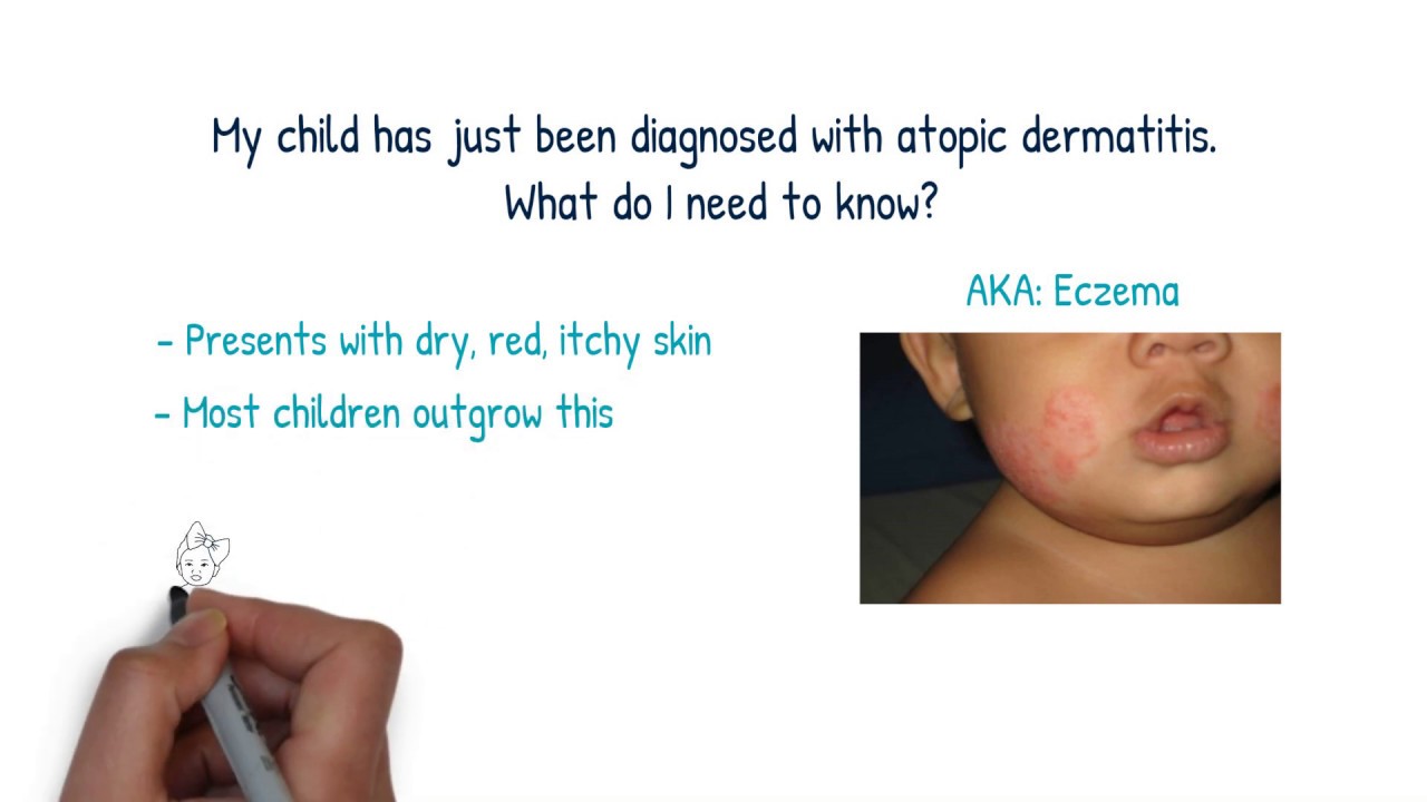 Pediatric Atopic Dermatitis: Caretaker Education