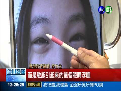 熬夜又吃海鮮 女大生腫成金魚眼