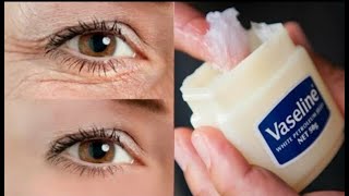 In 3 days Remove Under Eye Bags Completely | Remove Dark Circle, Wrinkles, puffy Eyes.