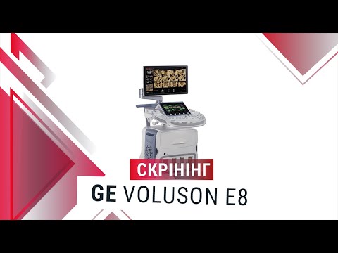 Якість зображення на GE Voluson E8 BT16 (скрінінг) - Статті RH