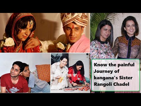 download lagu mp3 mp4 Kangana Ranauts Sister Pics Before Acid Attack, download lagu Kangana Ranauts Sister Pics Before Acid Attack gratis, unduh video klip Kangana Ranauts Sister Pics Before Acid Attack