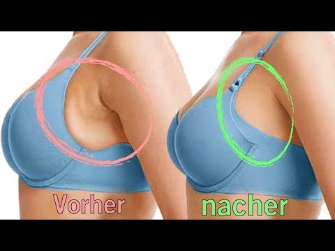 Eine diätetische Ernährung bei die Schuppenflechte Der Gründe nejrodermit bei den Kindern