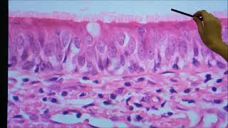 Polaridade celular e estruturas de superfície livre