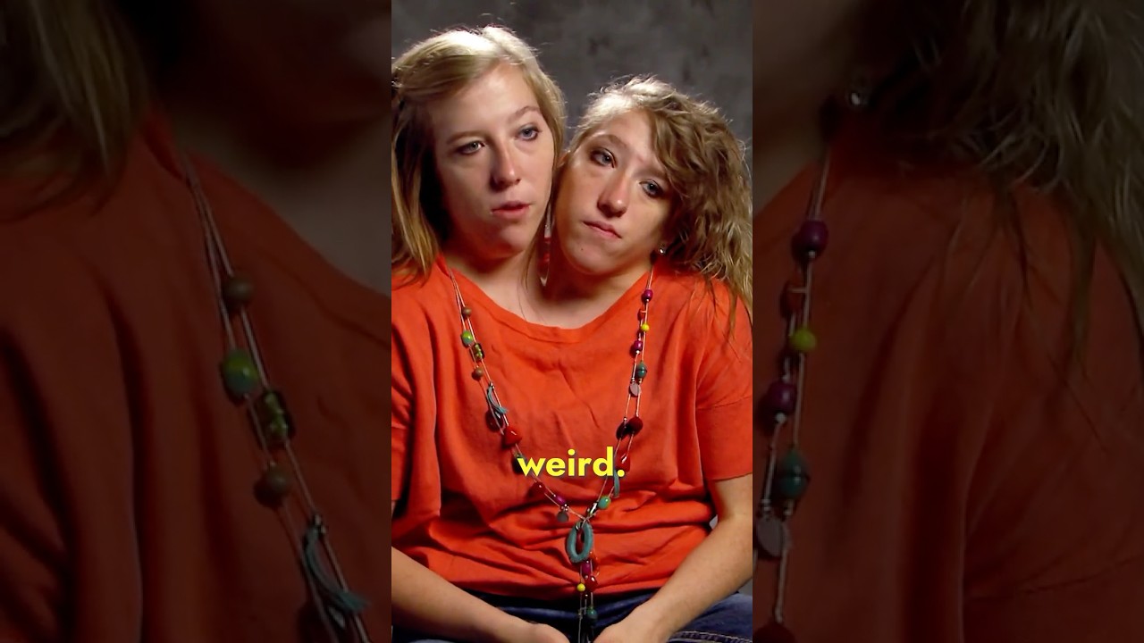Conjoined Twins Answer the Most Googled Questions