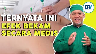 Download lagu DOCTOR REVEALS THE SCIENTIFIC SECRET OF CUPPING THERAPY! mp3 Download lagu DOCTOR REVEALS THE SCIENTIFIC SECRET OF CUPPING THERAPY! mp3