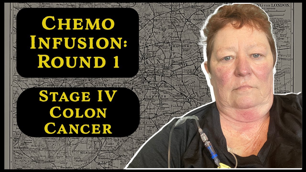 Chemotherapy Folfiri + Avastin | First Infusion | A Stage IV Colon Cancer Patient's Perspective 2025