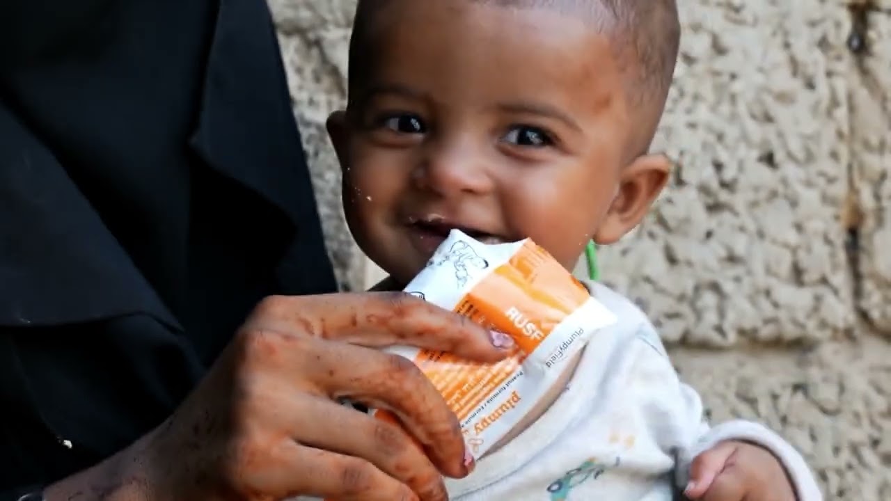 Contro la malnutrizione dei bambini non serve un miracolo. Serve una cura