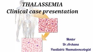 THALASSEMIA Clinical case presentation