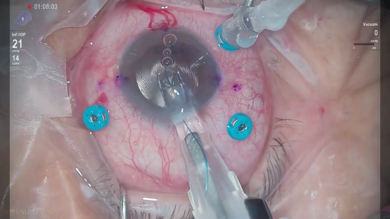 Pablo Angel Garcia Uribe-8