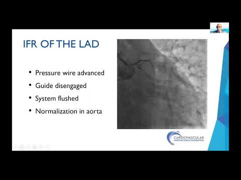 Coronary Physiology and Imaging: Step-by-Step