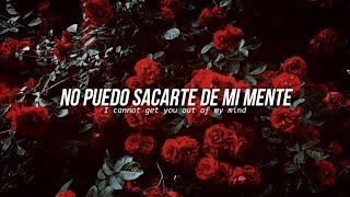 Lovebug • Jonas Brothers | Letra en español / inglés