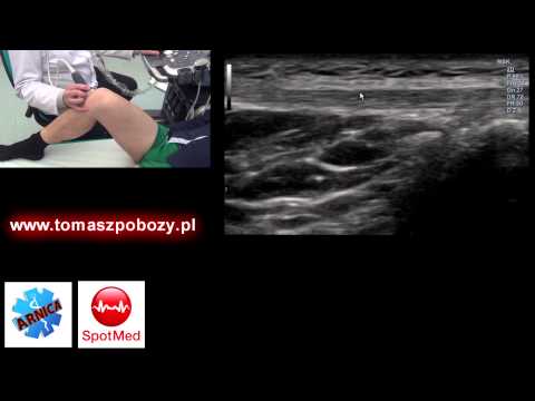 Łzawienie narośla na palcach Tradycyjnej medycyny z koślawości stóp
