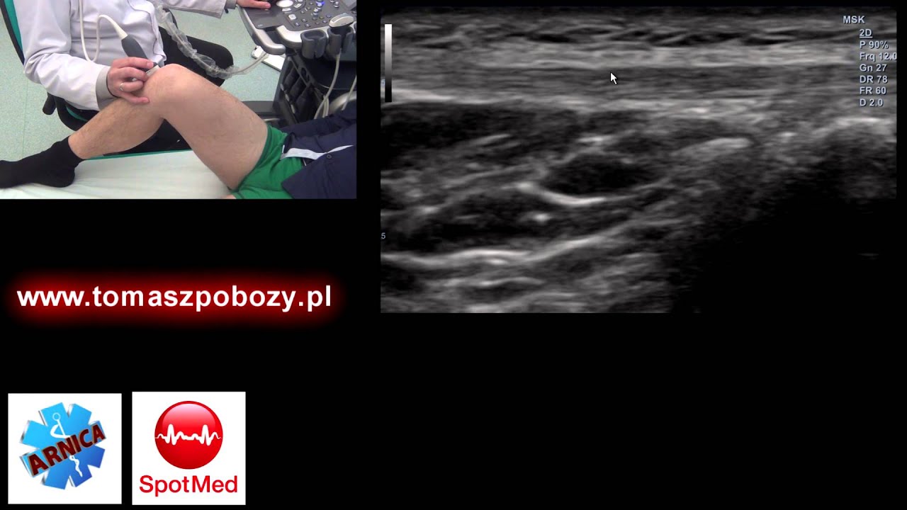 USG kolana — badanie krok po kroku