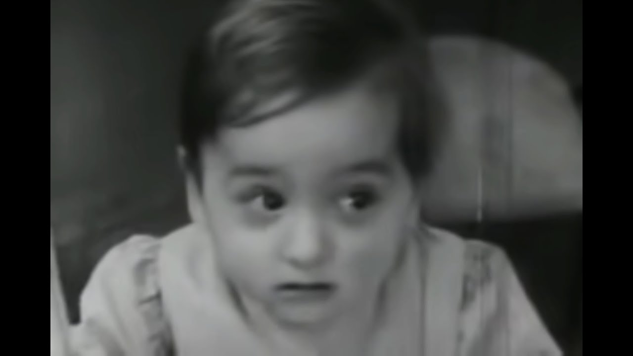 Study of Maternal Deprivation | Before and After Therapy