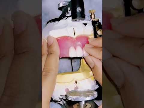 Teeth Setup for Complete Denture #youtubeshorts #youtube #ytshorts #smartdentistry