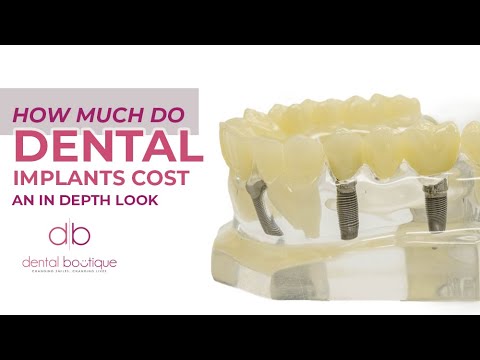 YouTube video about: How much do dental implants cost in nebraska?
