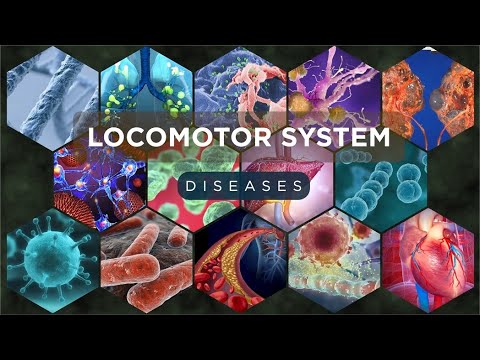 Locomotor System Diseases Explained – Causes, Symptoms, & Treatments