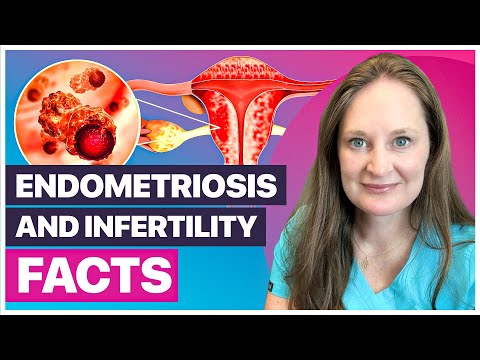 5 Ways Endometriosis Impacts Fertility: What You Need to Know Now