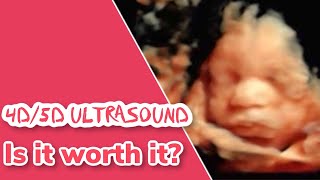 4D Ultrasound Experience| During Covid19 | Is it worth it?