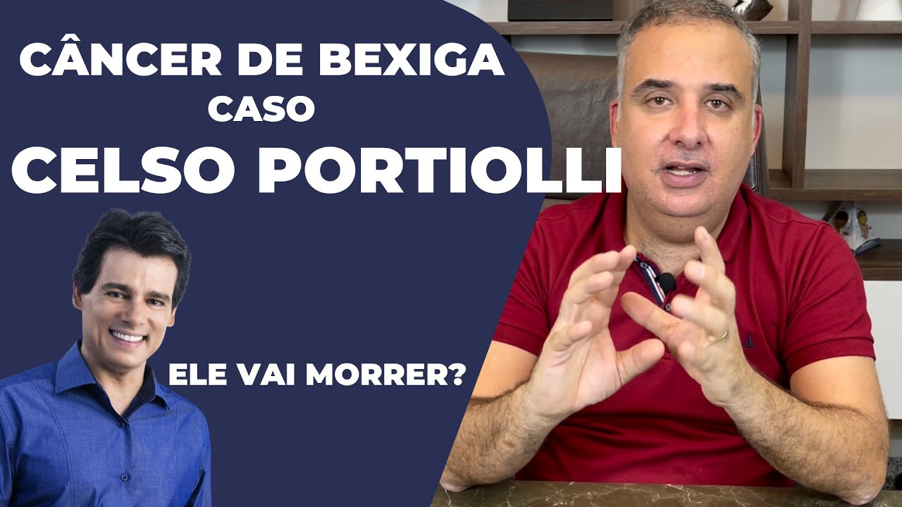 Câncer de bexiga - caso Celso Portiolli | Dr. Élio Arão Júnior