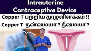 Intrauterine Contraceptive Device | Copper T பற்றிய முழுவிளக்கம் !! Copper T  நன்மையா ? தீமையா ?