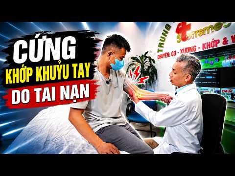 Cứng Khớp Khuỷu Tay: Chậm 1 Tháng Có Thể Mất Cả Đời!