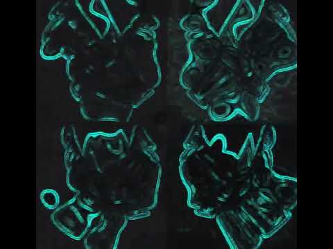 Lysergica brain _ Biologia 