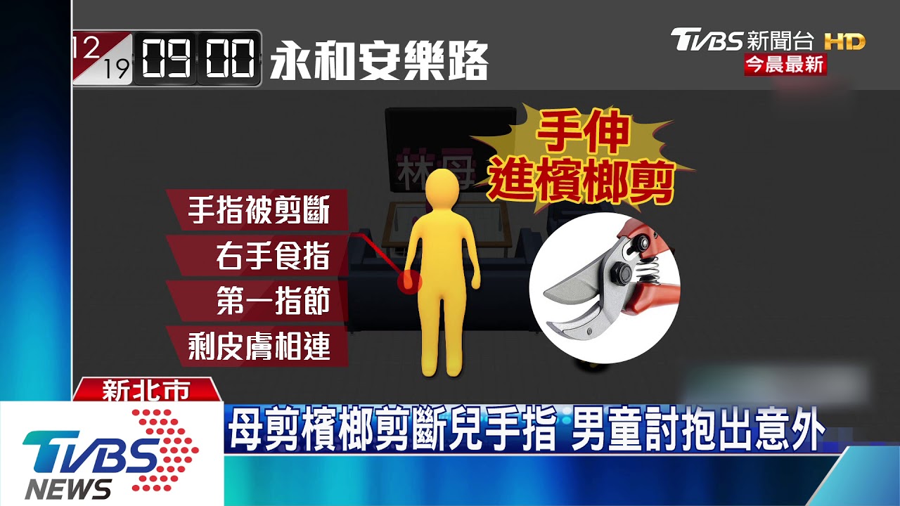 母剪檳榔剪斷兒手指 男童討抱出意外