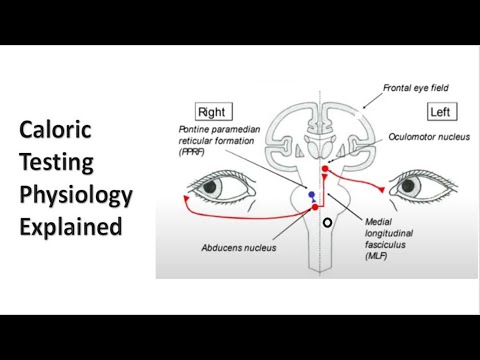 Caloric Testing Explained