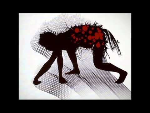 Miguel Calderon (Intestino Grueso)