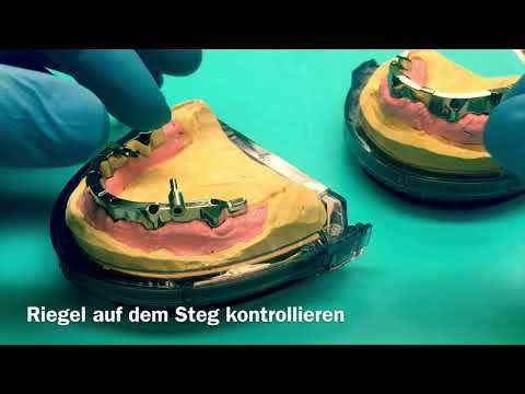 Stegarbeit  auf Implantat