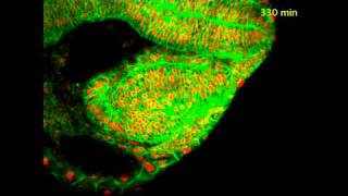 Zebrafish eye morphogenesis