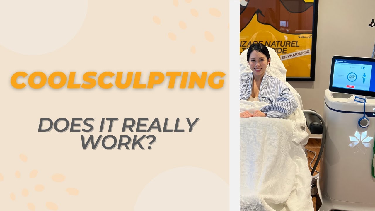Does CoolSculpting Really Work?
