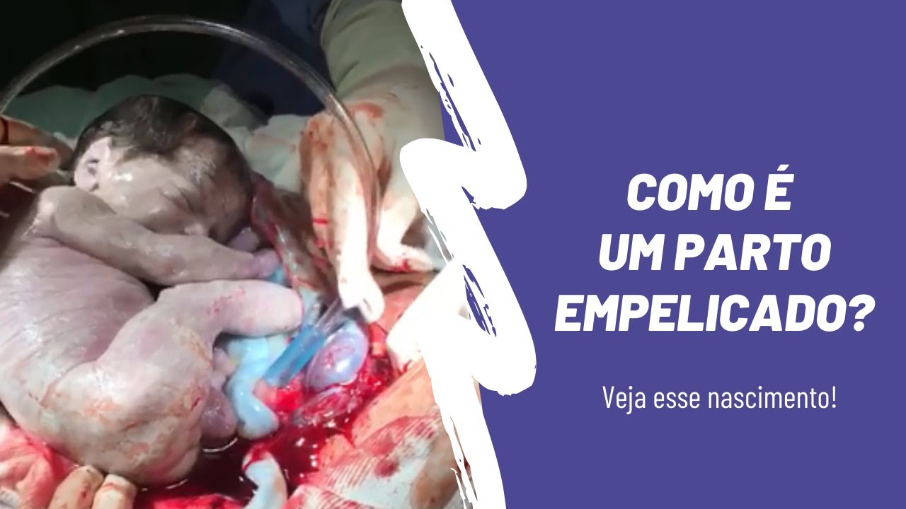 Fabiano Elisei Serra-23