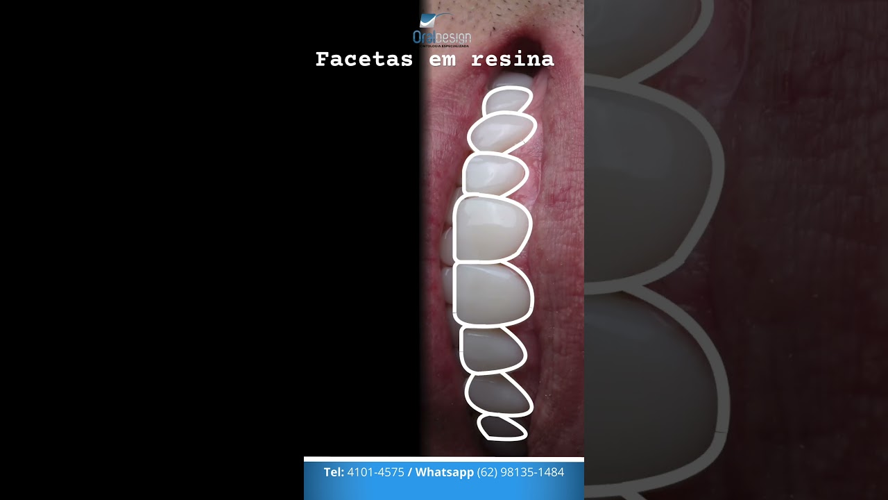Danilo Monteiro Rezende Pereira-36