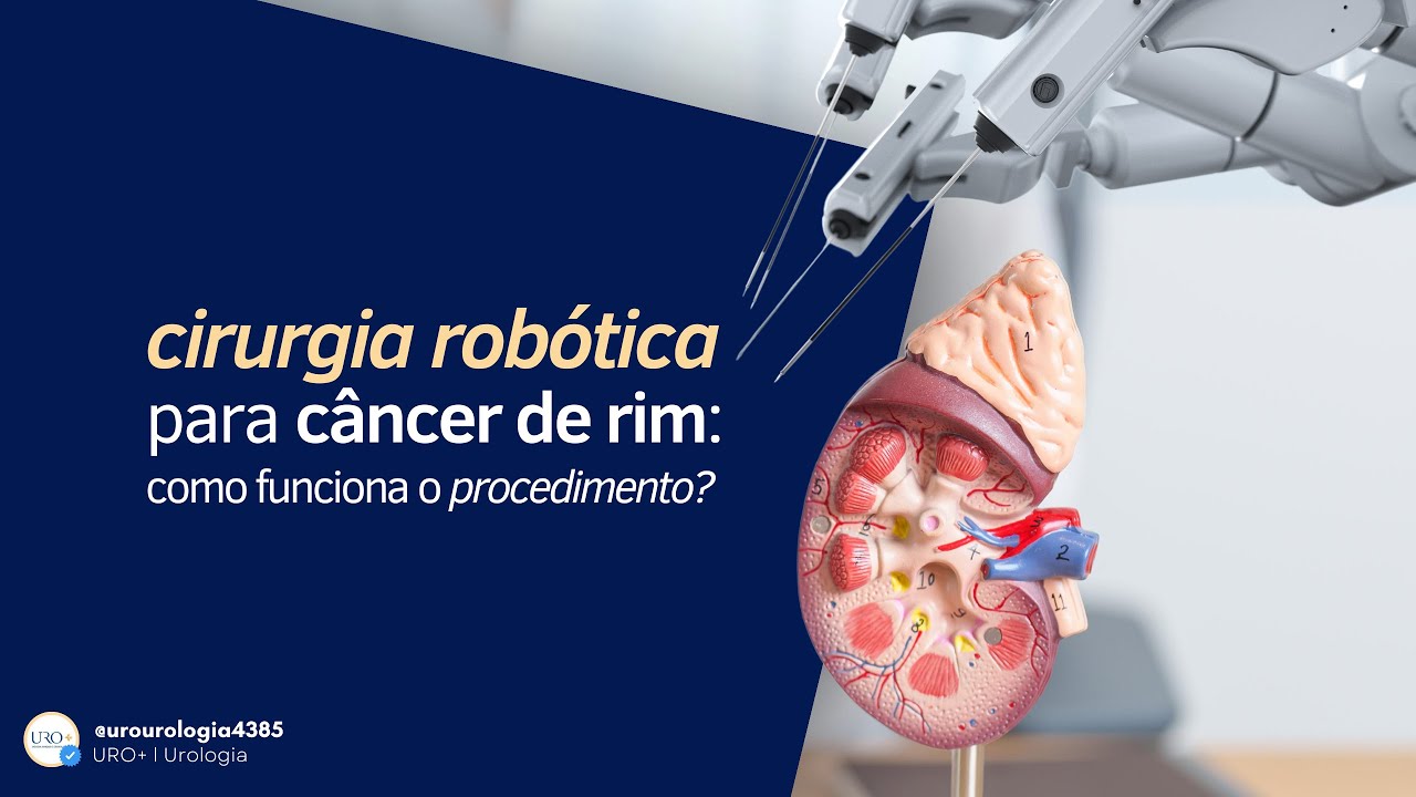 Felipe Amoedo Luedy-16