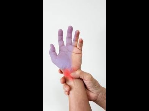 Chiropractor Marine City | Dr Morgan Explains how to Test and Treat Carpal Tunnel Wrist Pain part 1