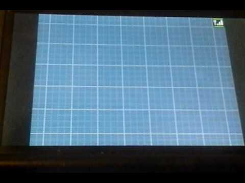 Pokemon white 2 ep 11 (Double Grass)