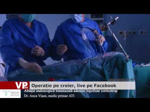 Operație pe creier, live pe Facebook