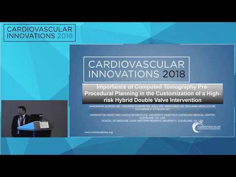 CVI2018: Structural Challenging Case Competition: Semifinals 2 (Friday, July 27)