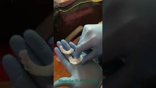Snap on smile Oujda