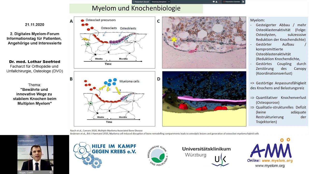 Bewährte und innovative Wege zu stabilem Knochen bei Myelom 2020