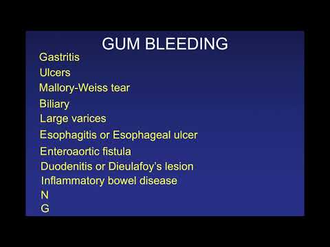 SCGIM Acute GI Bleeding WIP 2 20 19