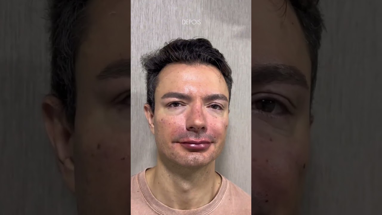 Rejuvenescimento