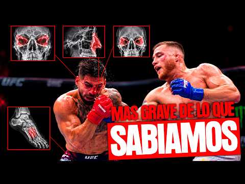 Video: ¡LESIONES SECRETAS!!!