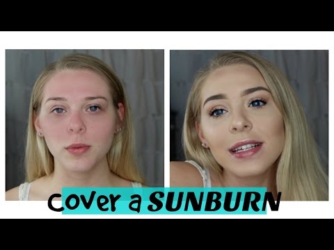 How To Cover a Sunburn | MAKEUP MONDAY - Lovey James