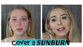 How To Cover a Sunburn | MAKEUP MONDAY - Lovey James