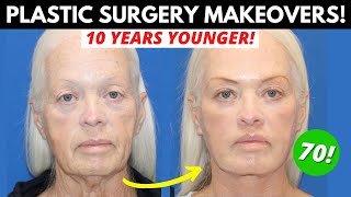 4 Women Get Life-Changing Plastic Surgery Makeovers: Everything They Had Done!