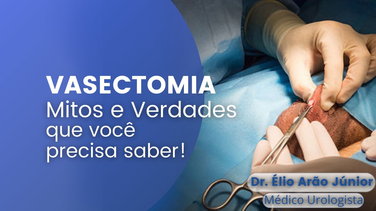 Vasectomia - Mitos e Verdade que você precisa saber!